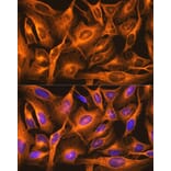 Immunofluorescence - Anti-beta Tubulin Antibody [ARC0203] (A306704) - Antibodies.com