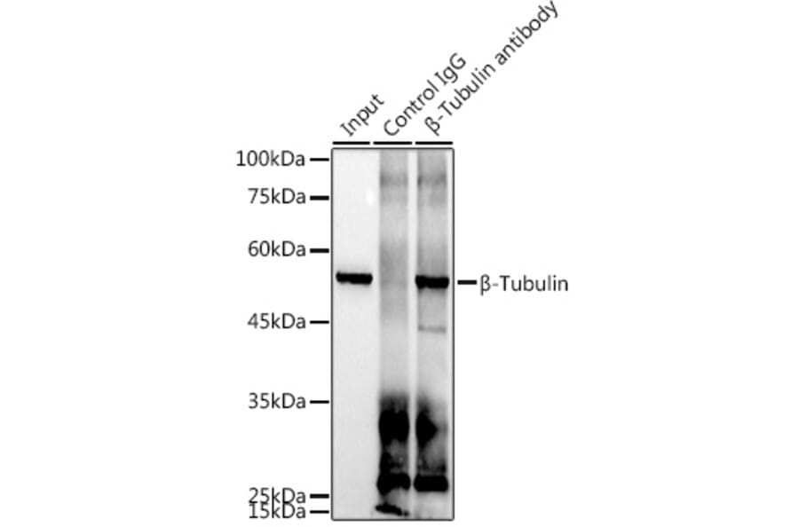 Western Blot - Anti-beta Tubulin Antibody [ARC0203] (A306704) - Antibodies.com
