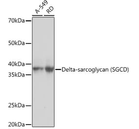 Western Blot - Anti-delta Sarcoglycan Antibody [ARC1463] (A306706) - Antibodies.com