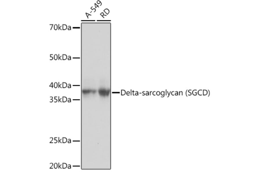 Western Blot - Anti-delta Sarcoglycan Antibody [ARC1463] (A306706) - Antibodies.com