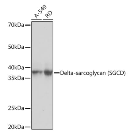 Western Blot - Anti-delta Sarcoglycan Antibody [ARC1463] (A306706) - Antibodies.com