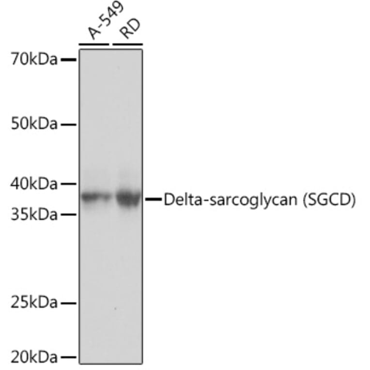 Western Blot - Anti-delta Sarcoglycan Antibody [ARC1463] (A306706) - Antibodies.com
