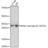 Western Blot - Anti-delta Sarcoglycan Antibody [ARC1463] (A306706) - Antibodies.com