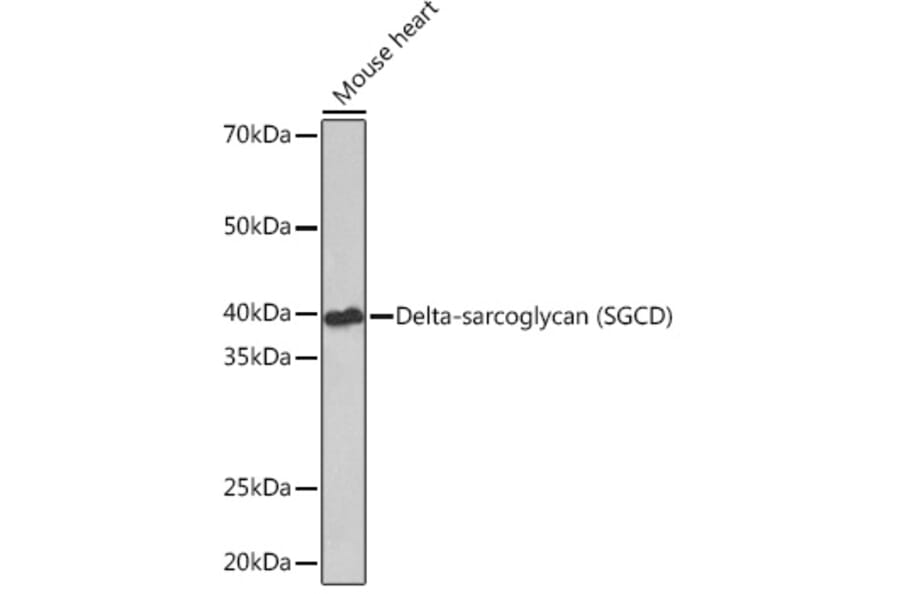 Western Blot - Anti-delta Sarcoglycan Antibody [ARC1463] (A306706) - Antibodies.com