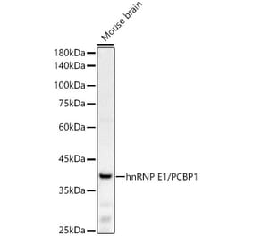 Western Blot - Anti-PCBP1 Antibody [ARC55411] (A306707) - Antibodies.com