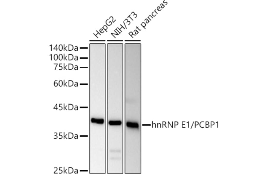 Western Blot - Anti-PCBP1 Antibody (A306708) - Antibodies.com