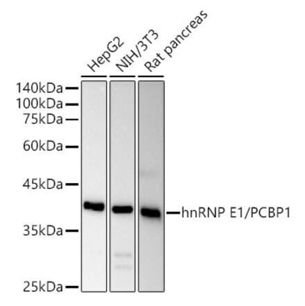 Western Blot - Anti-PCBP1 Antibody (A306708) - Antibodies.com