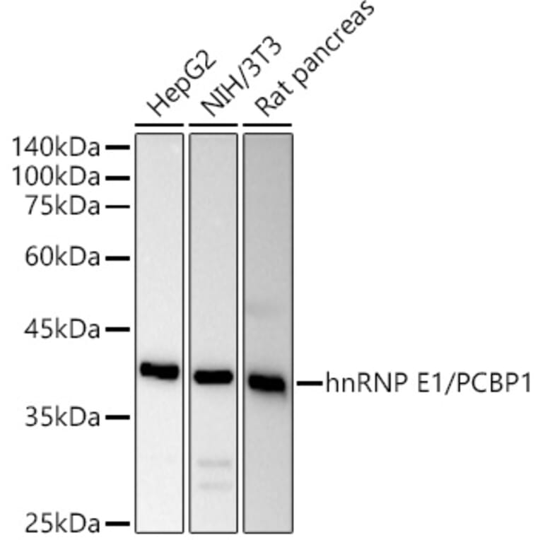 Western Blot - Anti-PCBP1 Antibody (A306708) - Antibodies.com