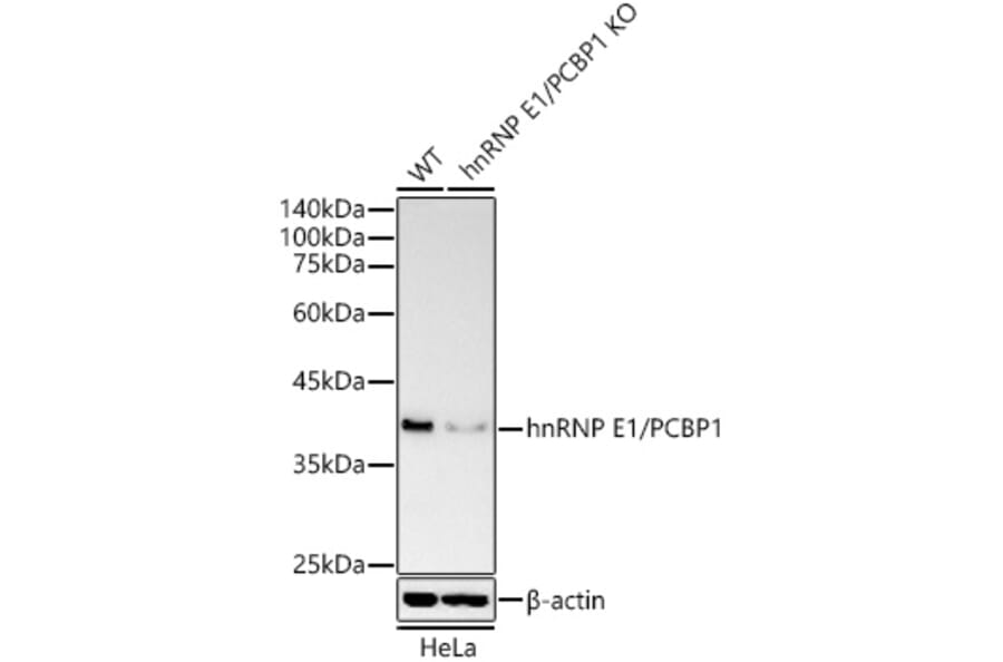 Western Blot - Anti-PCBP1 Antibody (A306708) - Antibodies.com