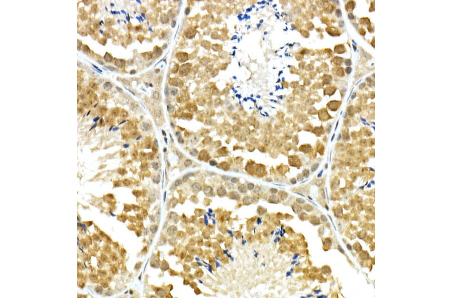 Immunohistochemistry - Anti-PCBP1 Antibody (A306708) - Antibodies.com