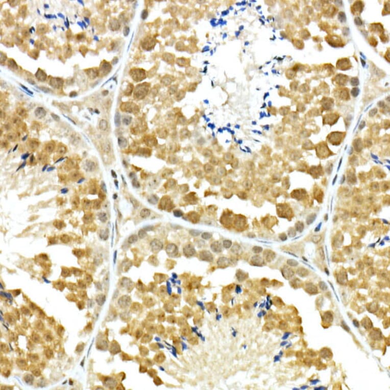 Immunohistochemistry - Anti-PCBP1 Antibody (A306708) - Antibodies.com