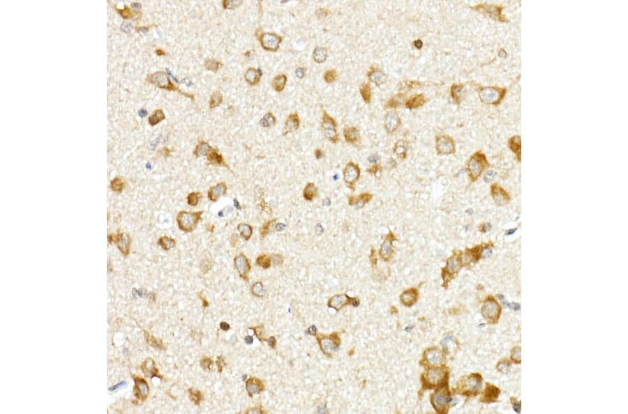 Immunohistochemistry - Anti-PCBP1 Antibody (A306708) - Antibodies.com