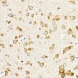 Immunohistochemistry - Anti-PCBP1 Antibody (A306708) - Antibodies.com