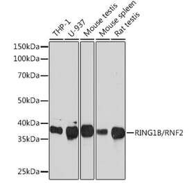 Western Blot - Anti-RING2 / RING1B / RNF2 Antibody [ARC0802] (A306709) - Antibodies.com