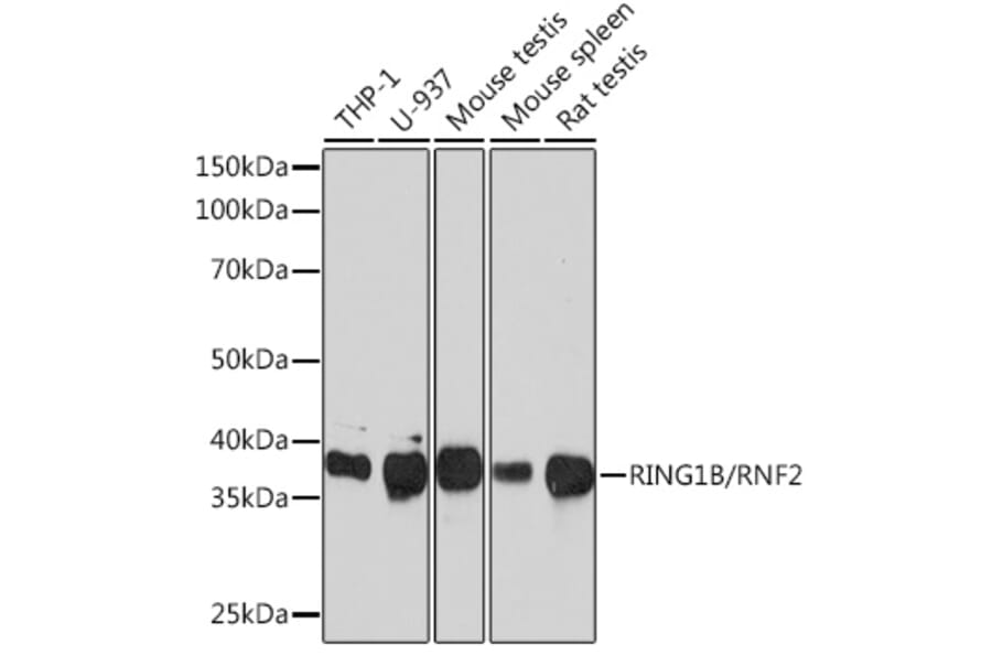 Western Blot - Anti-RING2/RING1B/RNF2 Antibody [ARC0802] (A306709) - Antibodies.com