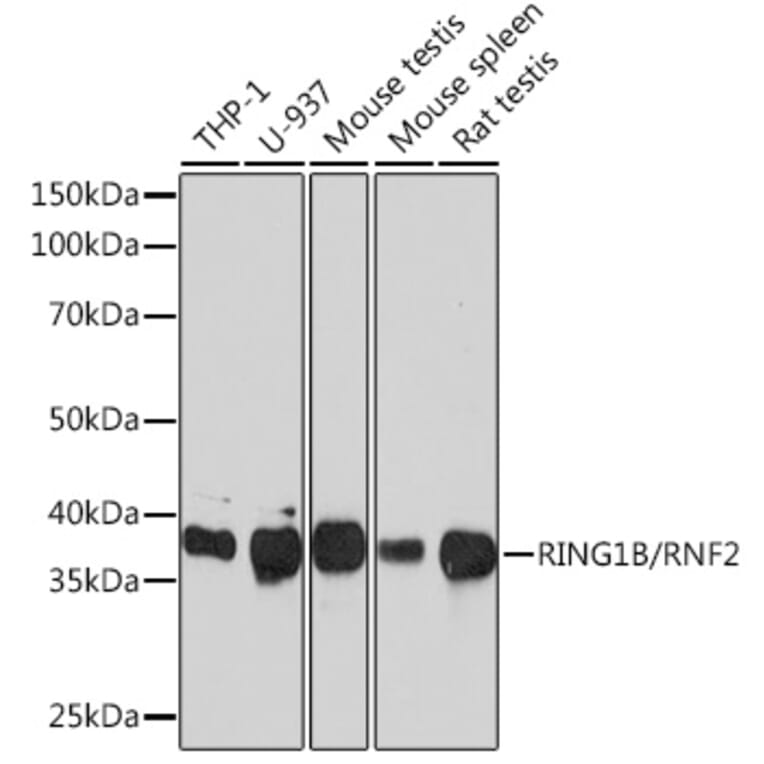 Western Blot - Anti-RING2/RING1B/RNF2 Antibody [ARC0802] (A306709) - Antibodies.com