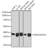 Western Blot - Anti-RING2/RING1B/RNF2 Antibody [ARC0802] (A306709) - Antibodies.com