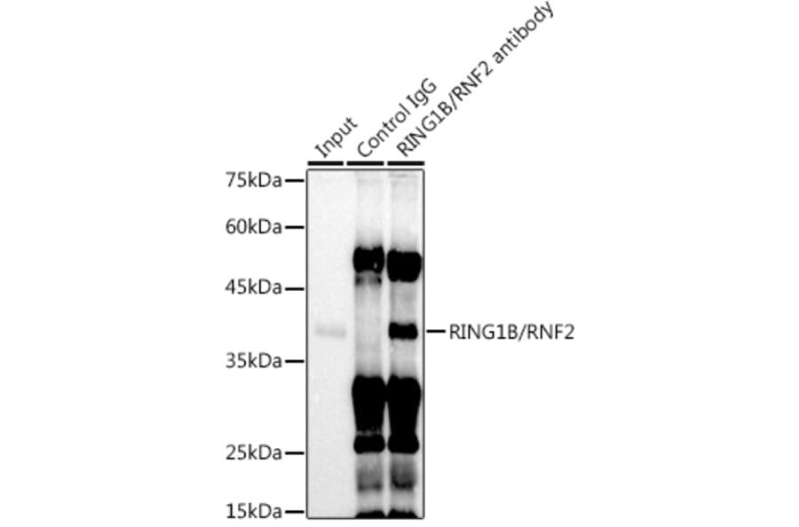 Western Blot - Anti-RING2/RING1B/RNF2 Antibody [ARC0802] (A306709) - Antibodies.com