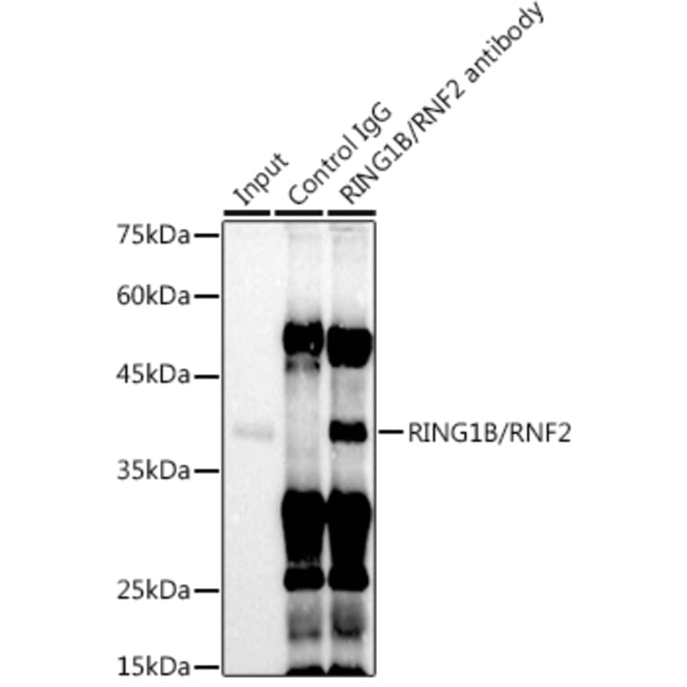 Western Blot - Anti-RING2/RING1B/RNF2 Antibody [ARC0802] (A306709) - Antibodies.com