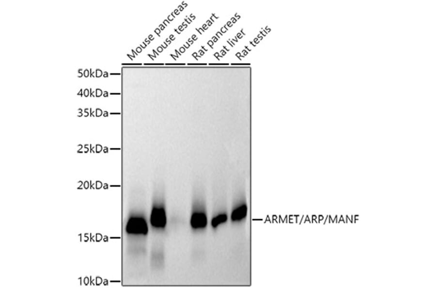 Western Blot - Anti-ARMET/ARP Antibody [ARC52199] (A306710) - Antibodies.com