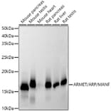 Western Blot - Anti-ARMET/ARP Antibody [ARC52199] (A306710) - Antibodies.com