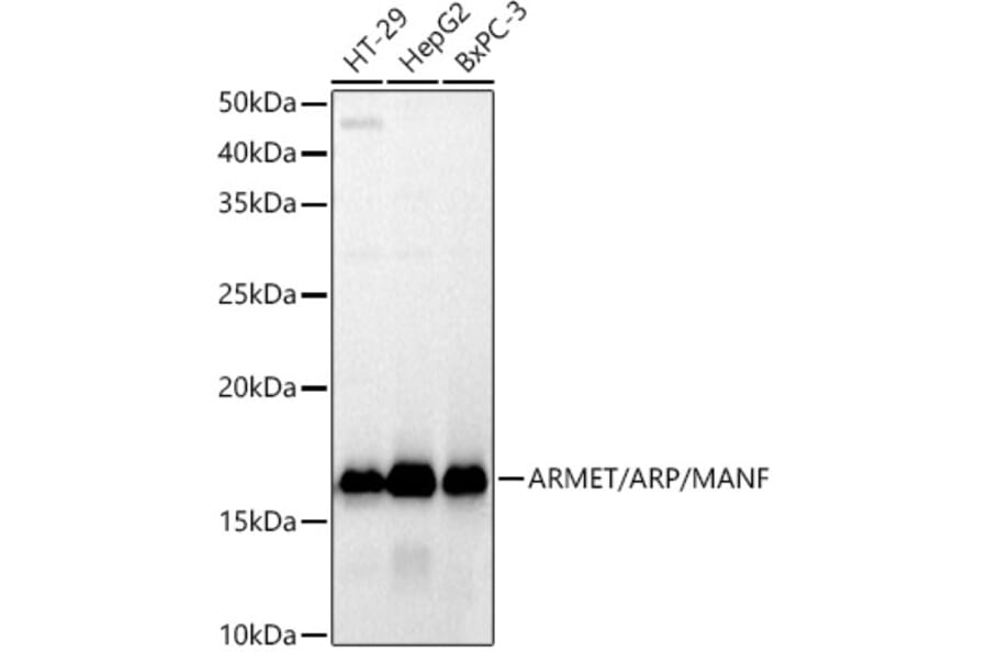 Western Blot - Anti-ARMET/ARP Antibody [ARC52199] (A306710) - Antibodies.com