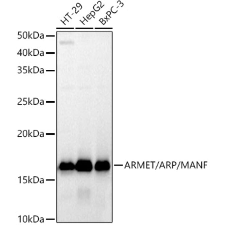 Western Blot - Anti-ARMET/ARP Antibody [ARC52199] (A306710) - Antibodies.com