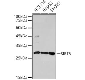Western Blot - Anti-SIRT5 Antibody (A306711) - Antibodies.com