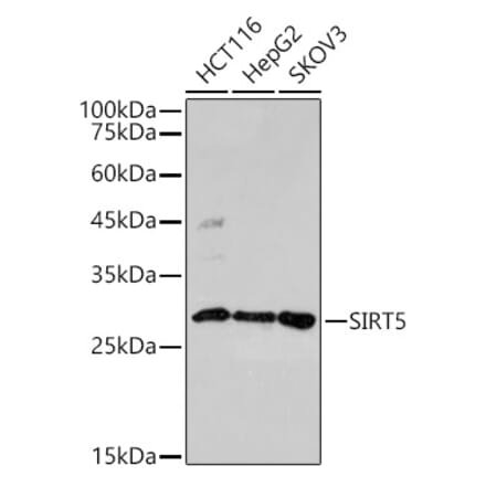 Western Blot - Anti-SIRT5 Antibody (A306711) - Antibodies.com