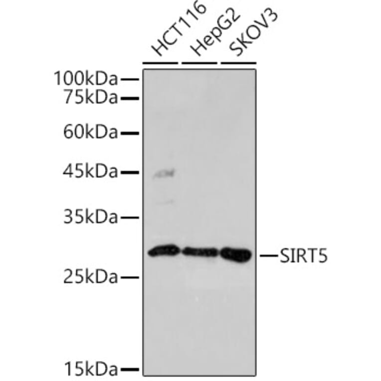 Western Blot - Anti-SIRT5 Antibody (A306711) - Antibodies.com