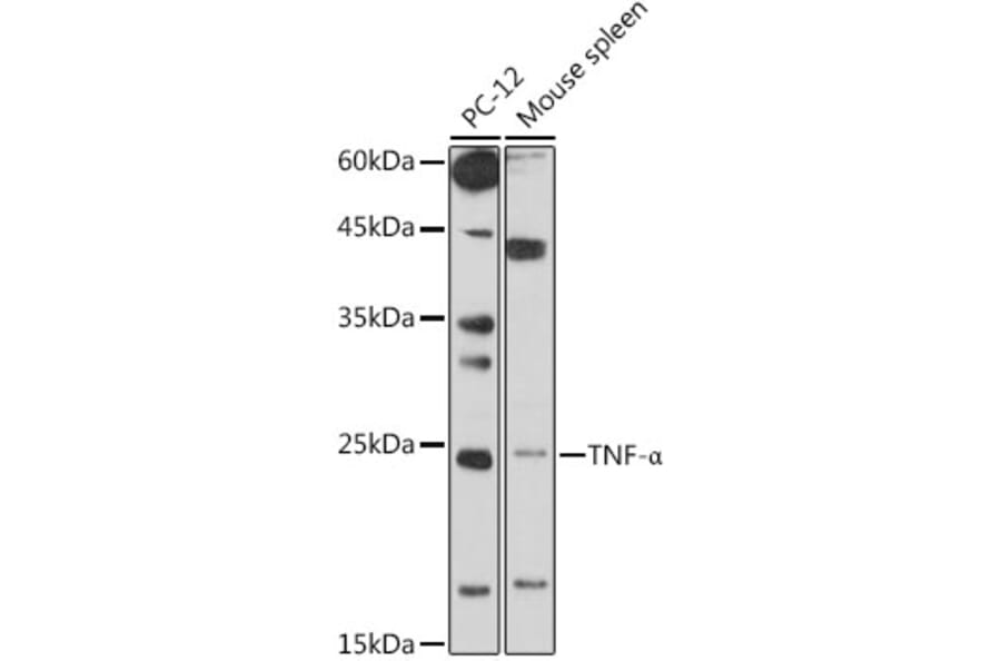 Western Blot - Anti-TNF alpha Antibody (A306714) - Antibodies.com