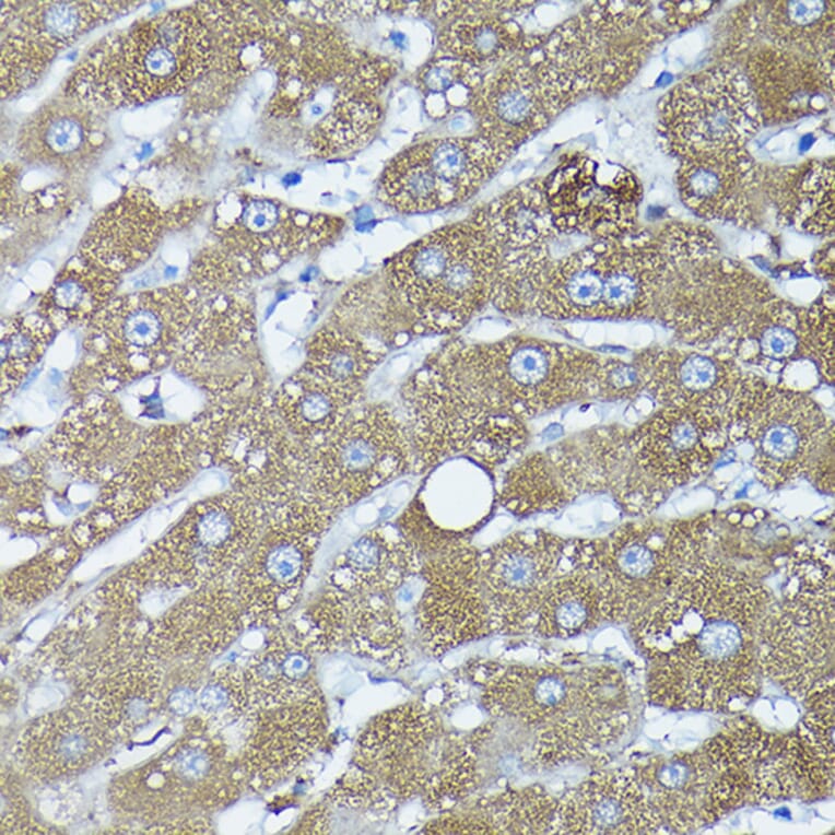 Immunohistochemistry - Anti-Frataxin Antibody (A306715) - Antibodies.com