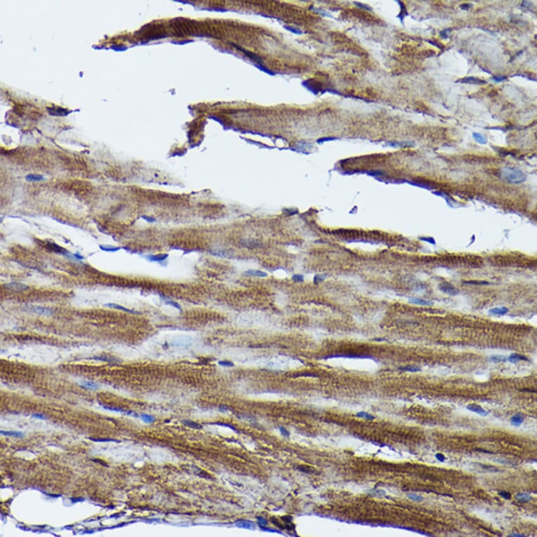 Immunohistochemistry - Anti-Frataxin Antibody (A306715) - Antibodies.com