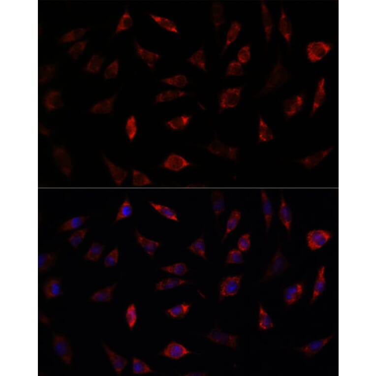 Immunofluorescence - Anti-Frataxin Antibody (A306715) - Antibodies.com