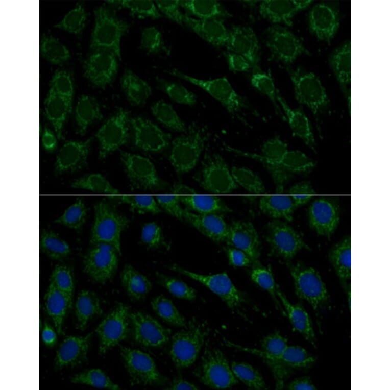 Immunofluorescence - Anti-Frataxin Antibody (A306715) - Antibodies.com