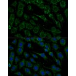 Immunofluorescence - Anti-Frataxin Antibody (A306715) - Antibodies.com