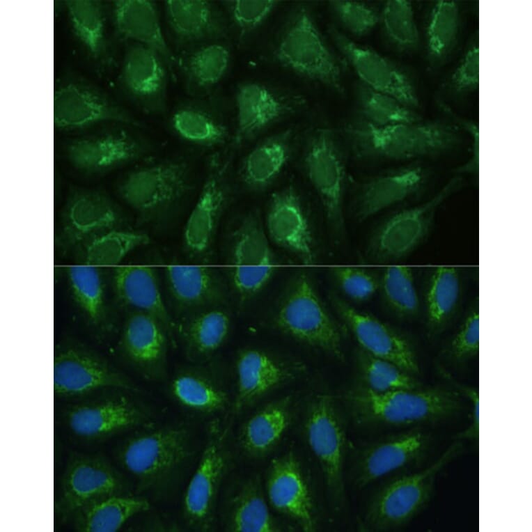 Immunofluorescence - Anti-Frataxin Antibody (A306715) - Antibodies.com