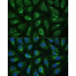 Immunofluorescence - Anti-Frataxin Antibody (A306715) - Antibodies.com