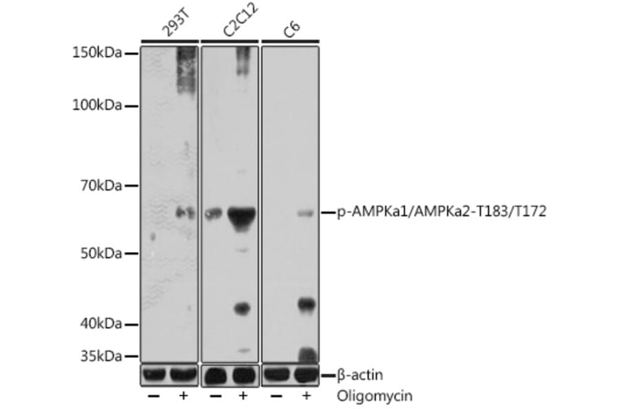 Western Blot - Anti-AMPK alpha 1 (phospho Thr183) + AMPK alpha 2 (phospho Thr172) Antibody (A306716) - Antibodies.com
