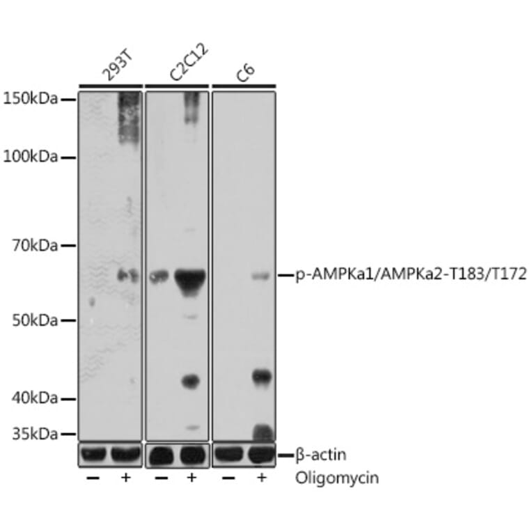 Western Blot - Anti-AMPK alpha 1 (phospho Thr183) + AMPK alpha 2 (phospho Thr172) Antibody (A306716) - Antibodies.com