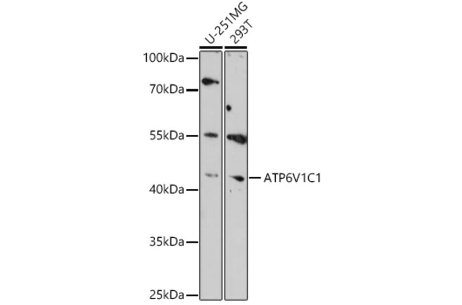 Western Blot - Anti-ATP6V1C1 Antibody (A306719) - Antibodies.com