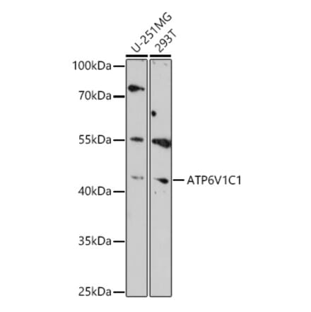 Western Blot - Anti-ATP6V1C1 Antibody (A306719) - Antibodies.com