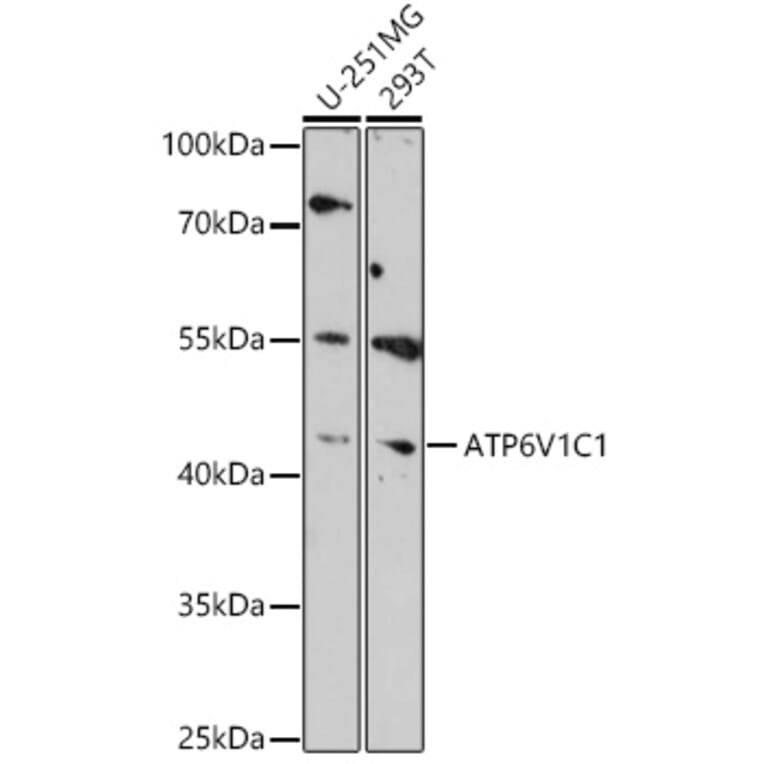 Western Blot - Anti-ATP6V1C1 Antibody (A306719) - Antibodies.com