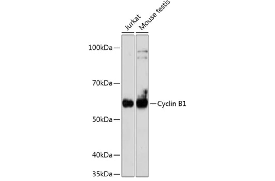 Western Blot - Anti-Cyclin B1 Antibody [ARC0474] (A306720) - Antibodies.com