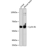 Western Blot - Anti-Cyclin B1 Antibody [ARC0474] (A306720) - Antibodies.com