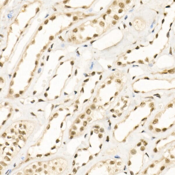 Anti-KDM1 / LSD1 Antibody (A306723) | Antibodies.com