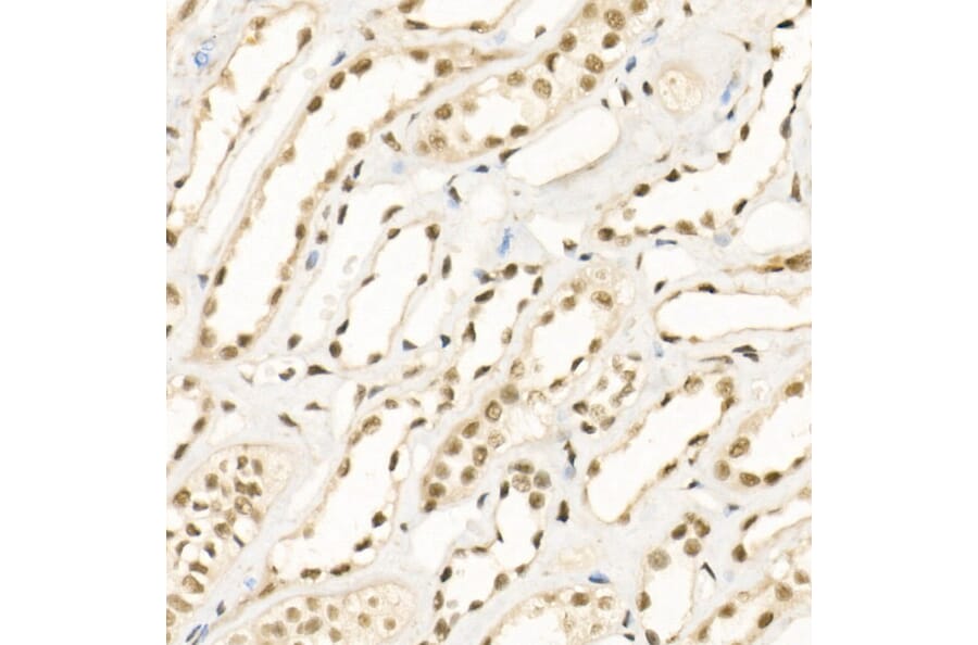 Immunohistochemistry - Anti-KDM1/LSD1 Antibody (A306723) - Antibodies.com