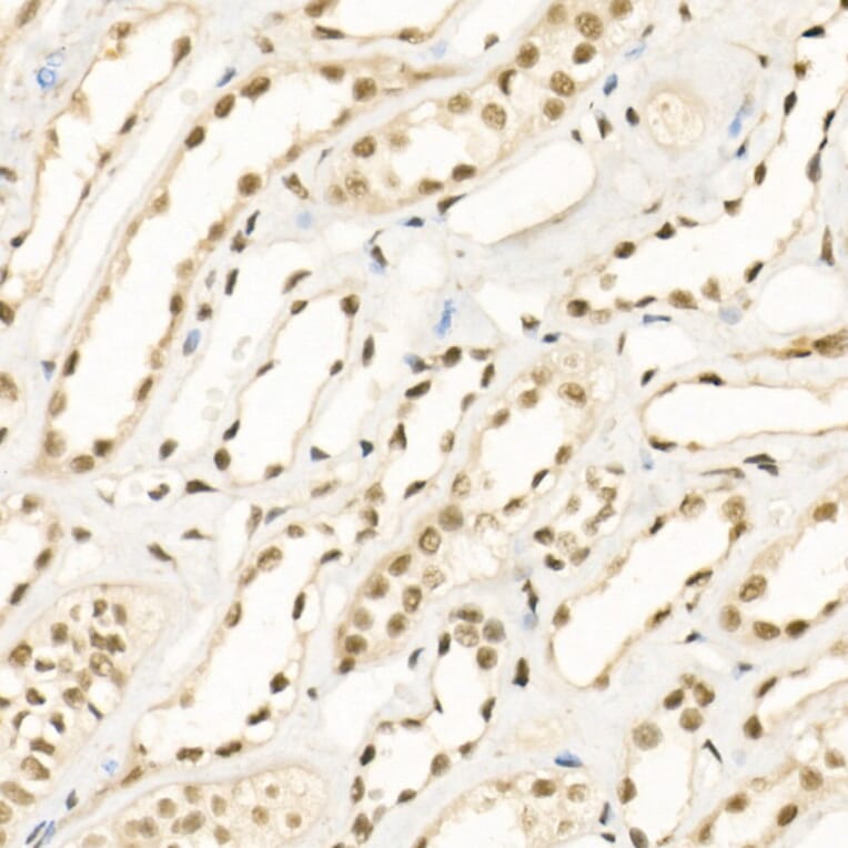 Immunohistochemistry - Anti-KDM1/LSD1 Antibody (A306723) - Antibodies.com