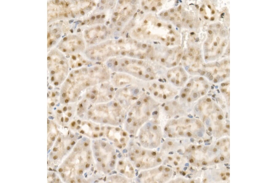 Immunohistochemistry - Anti-KDM1/LSD1 Antibody (A306723) - Antibodies.com