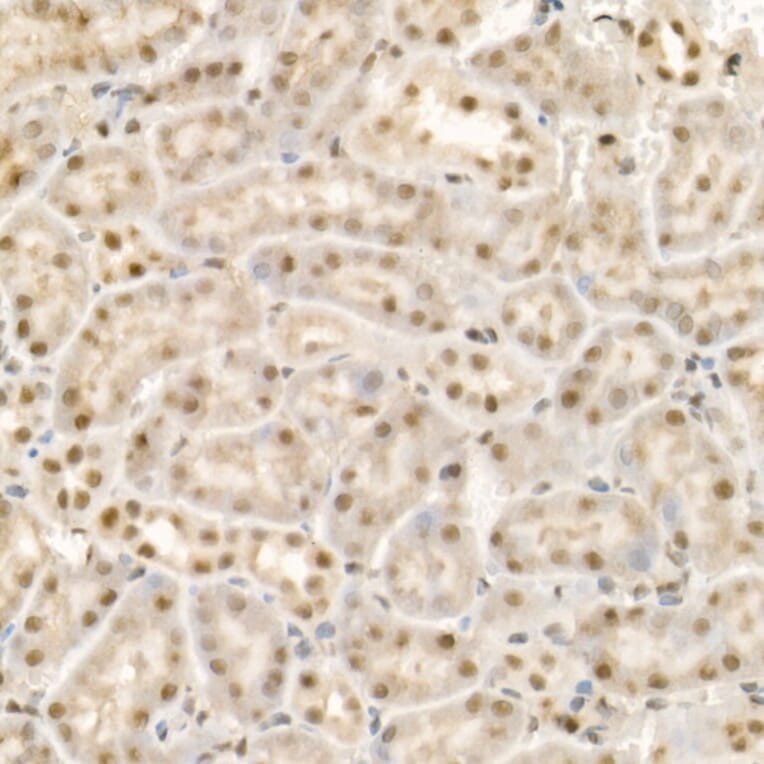 Immunohistochemistry - Anti-KDM1/LSD1 Antibody (A306723) - Antibodies.com